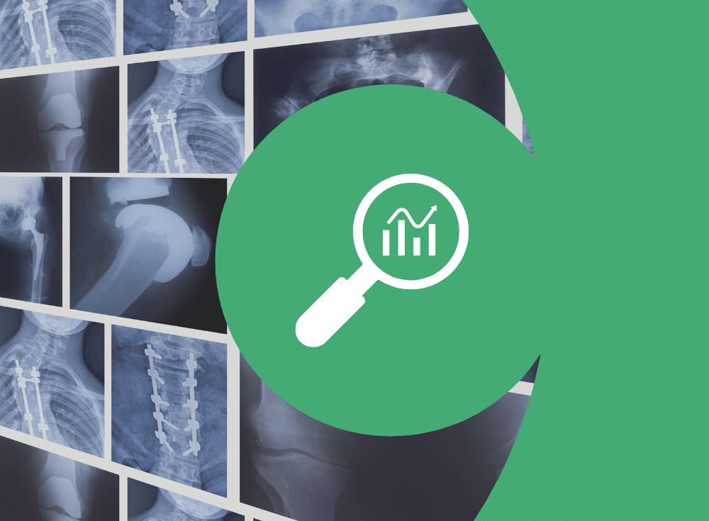 X-ray images of bones with metal implants are displayed in the background, while a magnifying glass with a data chart icon highlights transparent telemetry on a green circular overlay in the foreground.